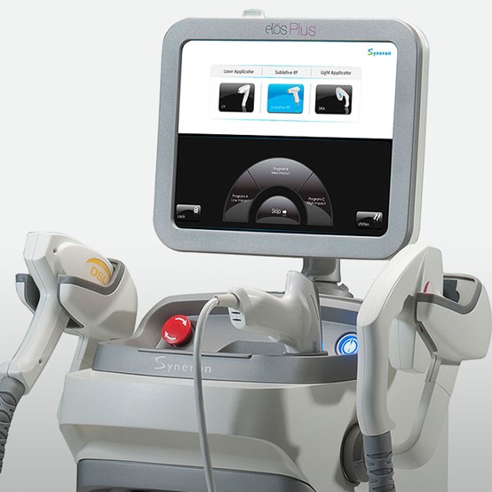 Elos Plus Multi-Platform Laser Treatment